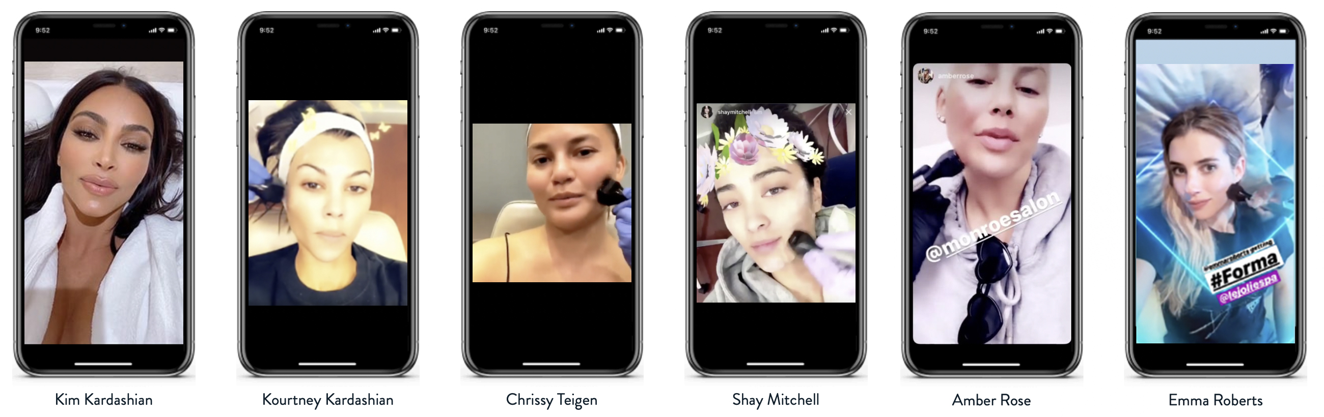 inmode Forma treatment loved by celebrities The Door W4