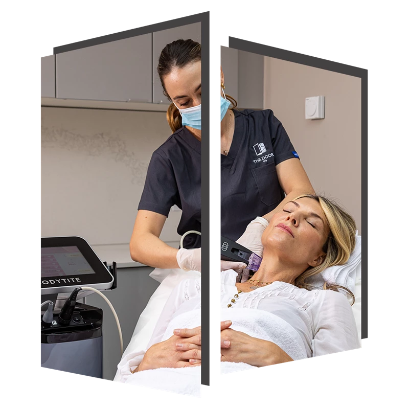 Morpheus8 skin tightening at The Door w4