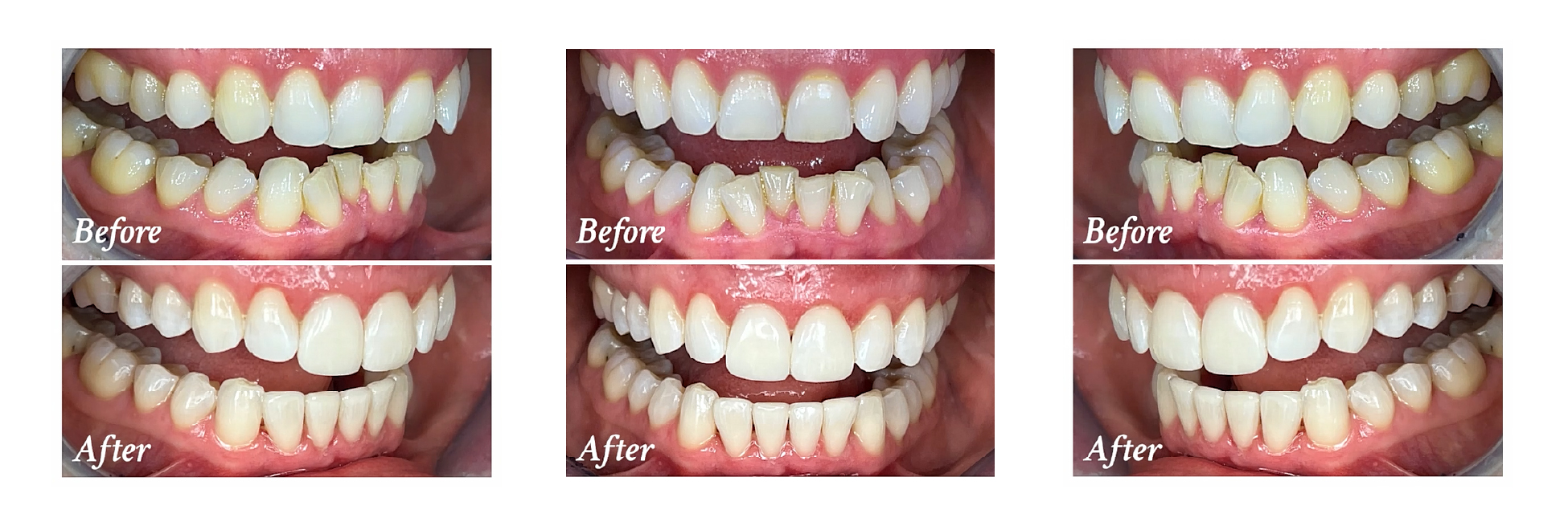 helen taylor before and after