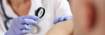 Mole, Cyst and Benign Lesion Removal