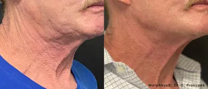 Neck