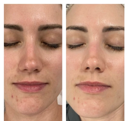 Infusion Lab Facial