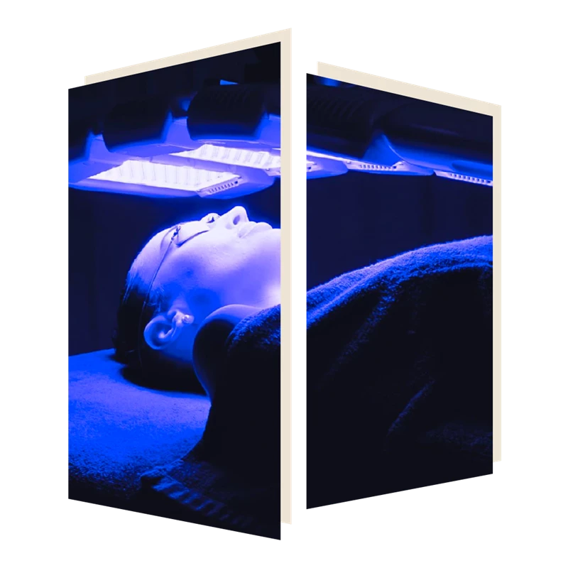 Dermaluxe Triwave Facial Treatment