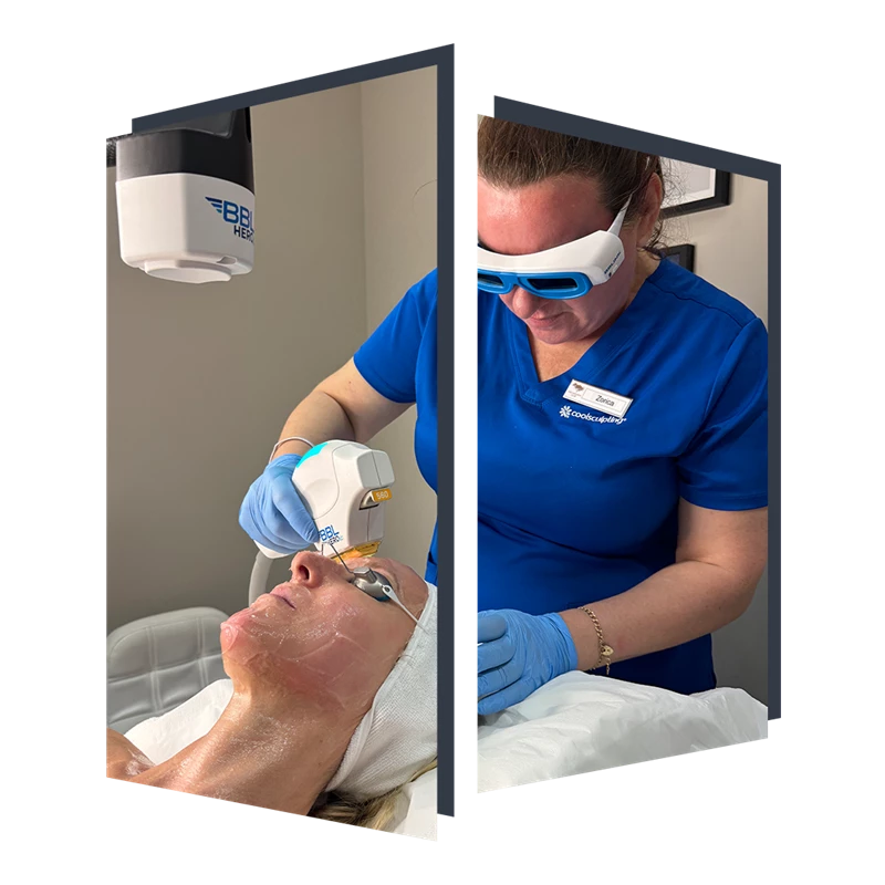 BBL HEROic at The Door W4 for skin rejuvenation