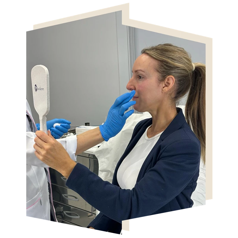 Kellie at The Door W4 Polynucleotide Treatment at Chiswick Clinic